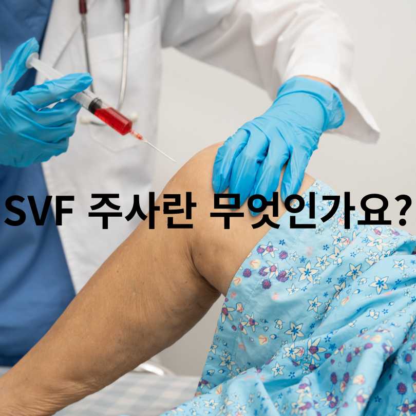 SVF 주사? 무릎 관절염 통증 줄이는 줄기세포 치료법