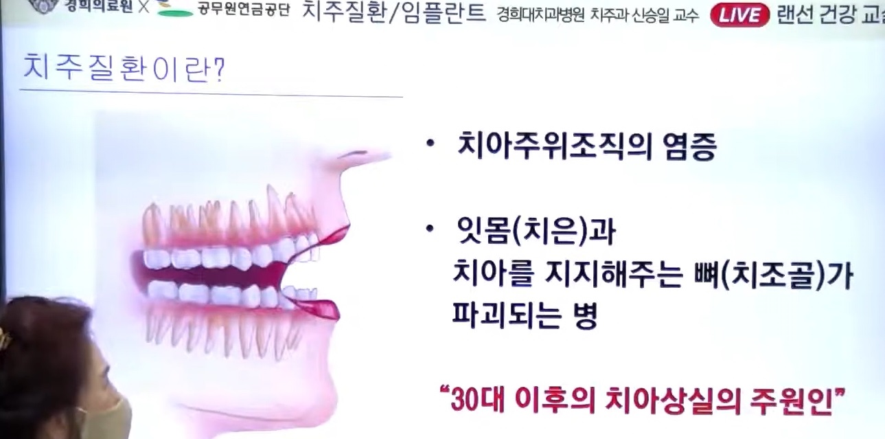 치주질환-신승윤-교수