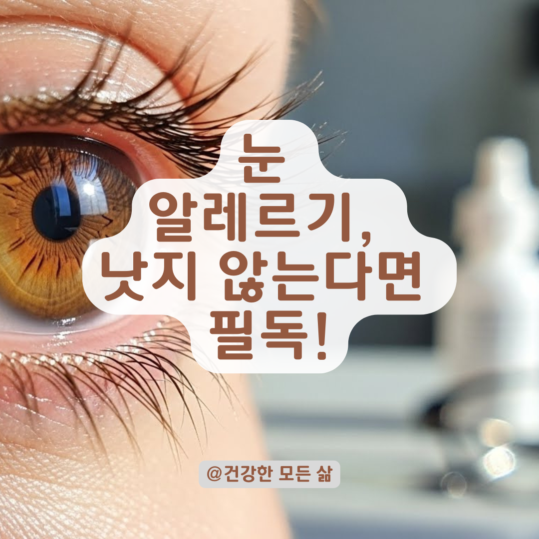 눈 알레르기, 왜 안 나을까? 우리가 몰랐던 치명적인 관리 실수 5가지