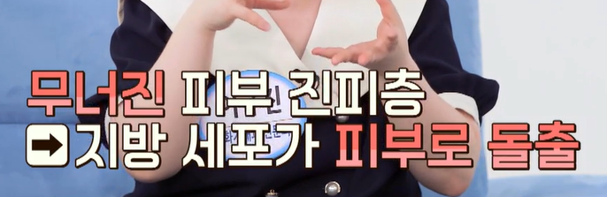 비오틴콜라겐