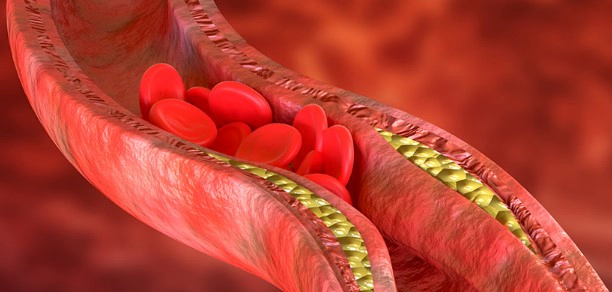 귀 혈액순환 잘 안되는 이유 및 혈액순환에 좋은 음식 추천