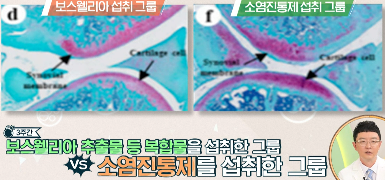 보스웰리아 효능
