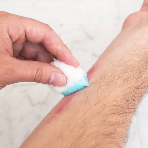 구강청결제 활용법,모기 물려서 가려울때 물파스