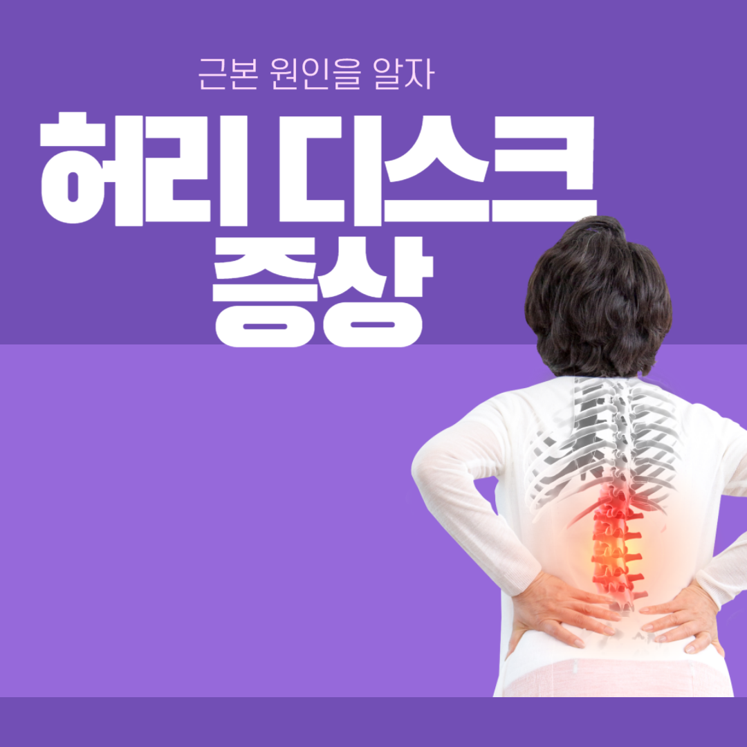허리디스크 증상 5가지