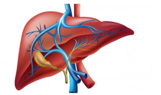 간수치 낮추는 법