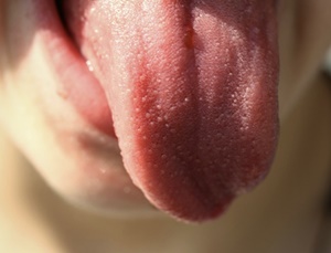 구내염 빨리 낫는 법