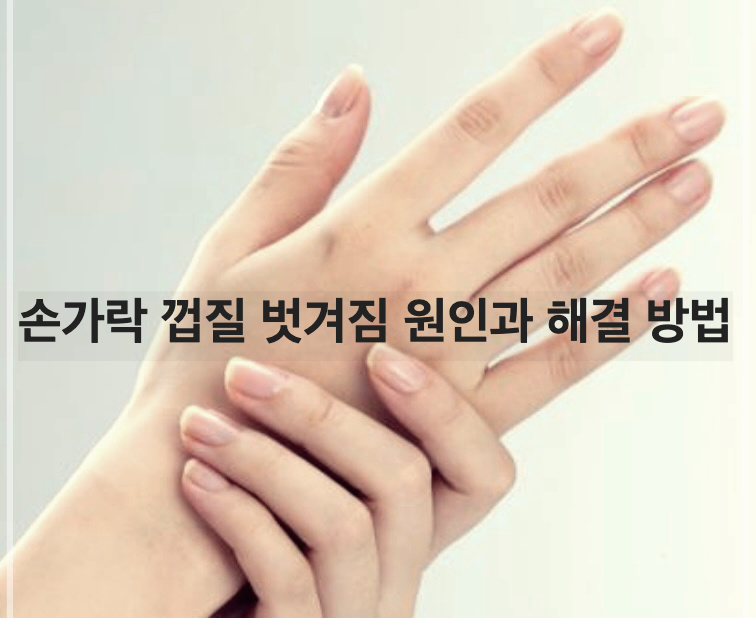 손가락 껍질 벗겨짐 원인과 해결 방법