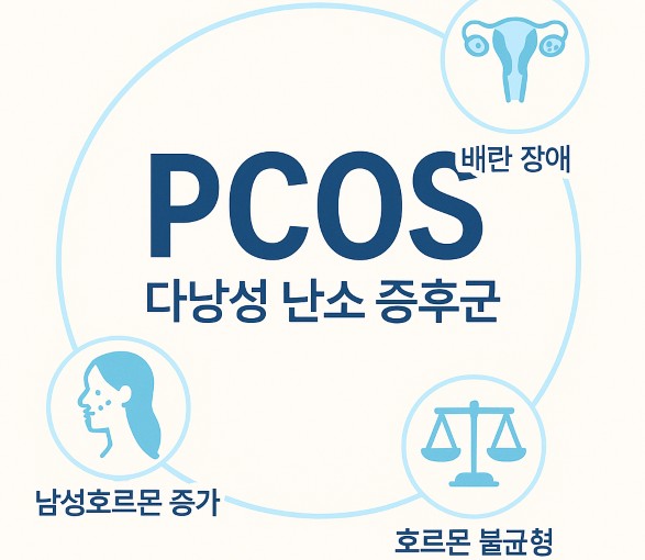 다낭성난소증후군의 대표적 증상표시한 그림