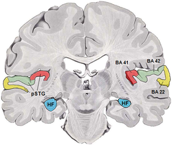 🧠 수면 부족이 해마에 미치는 영향 – 기억력의 적은 ‘잠 부족’이다