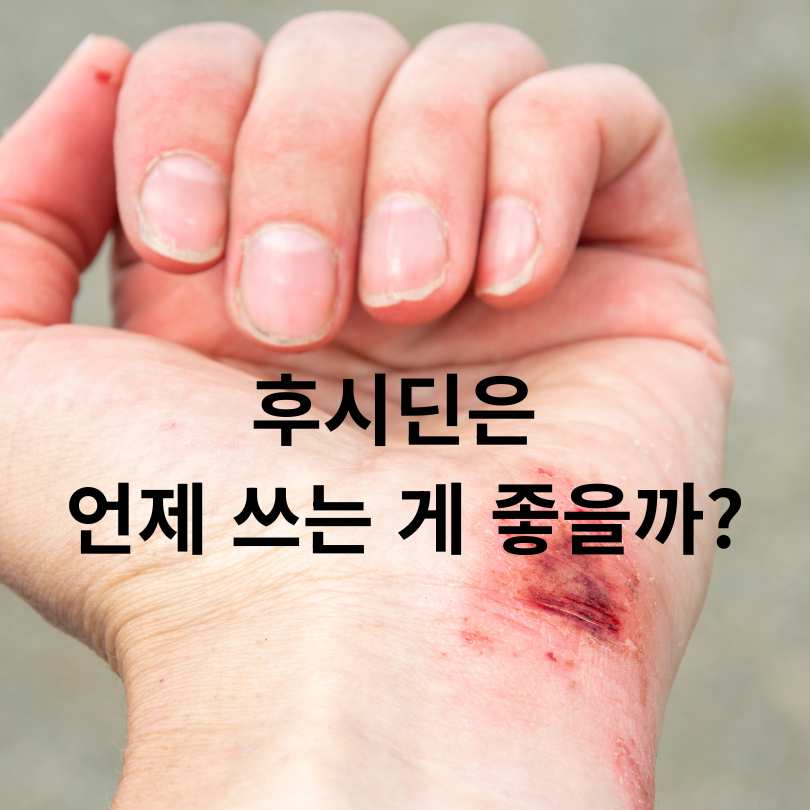 후시딘과 마데카솔 차이점 총정리!
