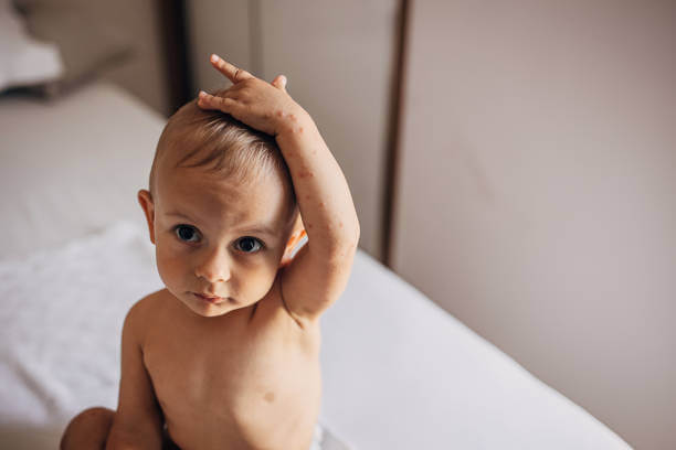 수족구 증상&amp;#44; 전염 및 잠복기와 예방까지! 수족구에 잠복기가 생기는 이유까지 알아봤습니다. 