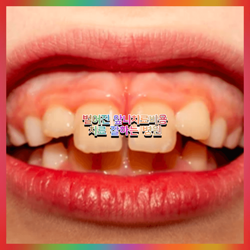 벌어진 앞니 교정치료 비용