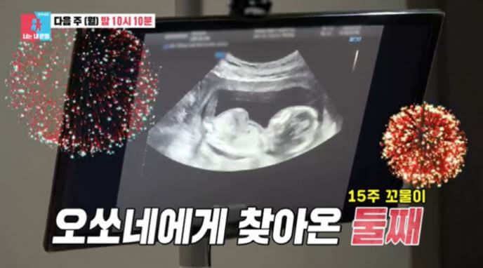 김소영 둘째 임신 초음파