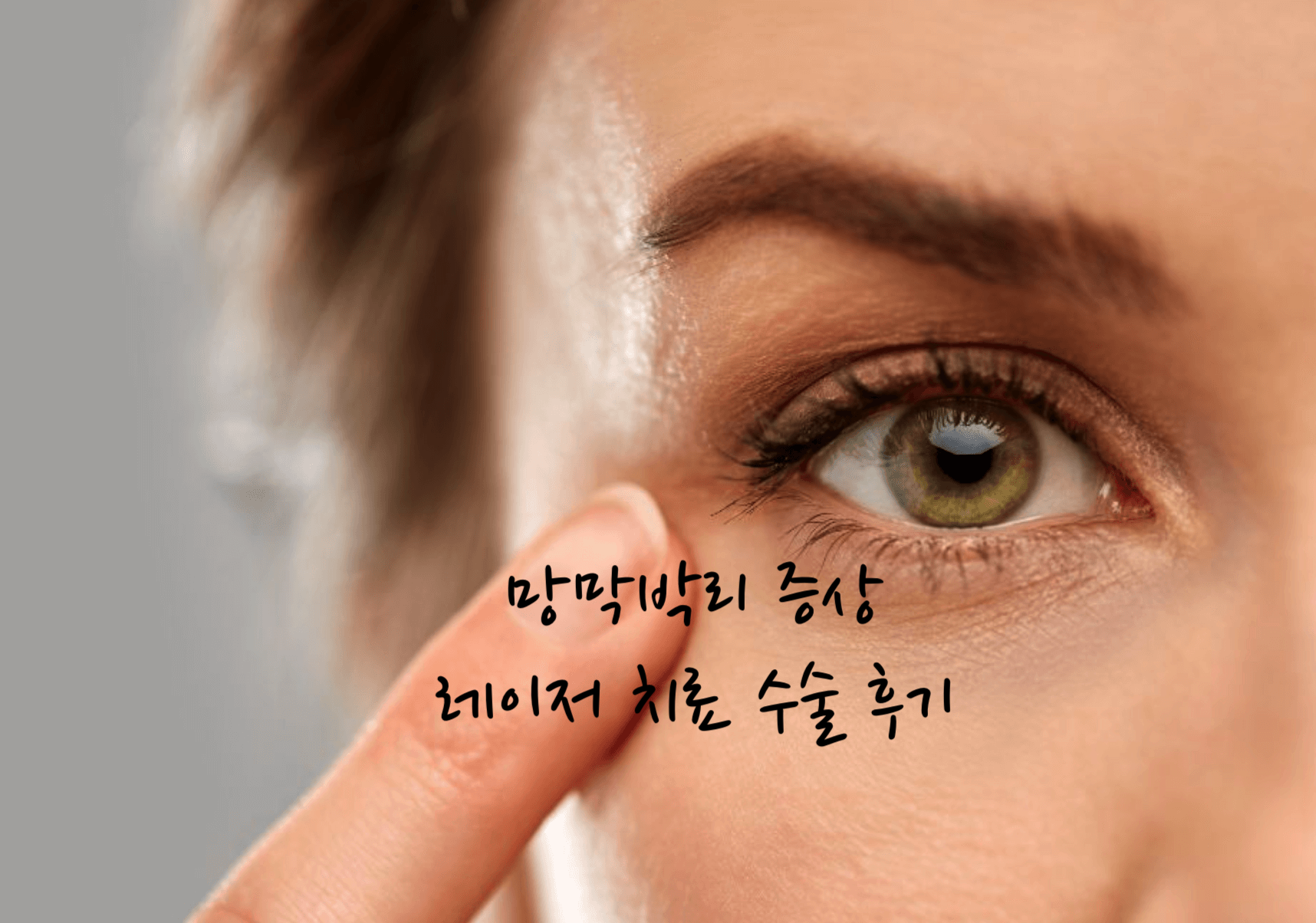망막박리 증상