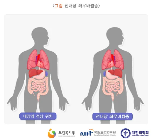 전내장역위증