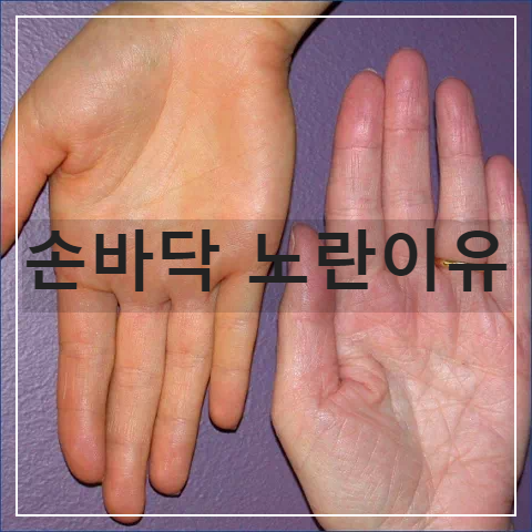손바닥 노란색