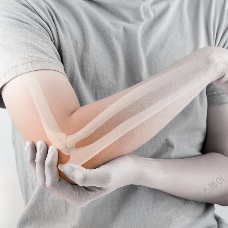 팔꿈치 바깥쪽 통증 원인 알려드립니다