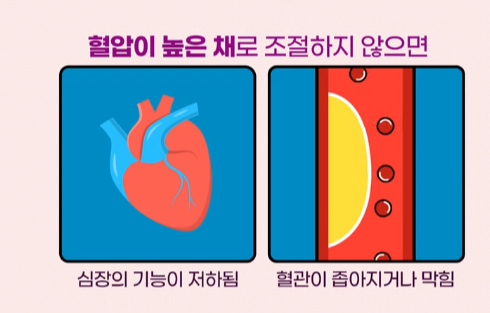 고혈압 합병증