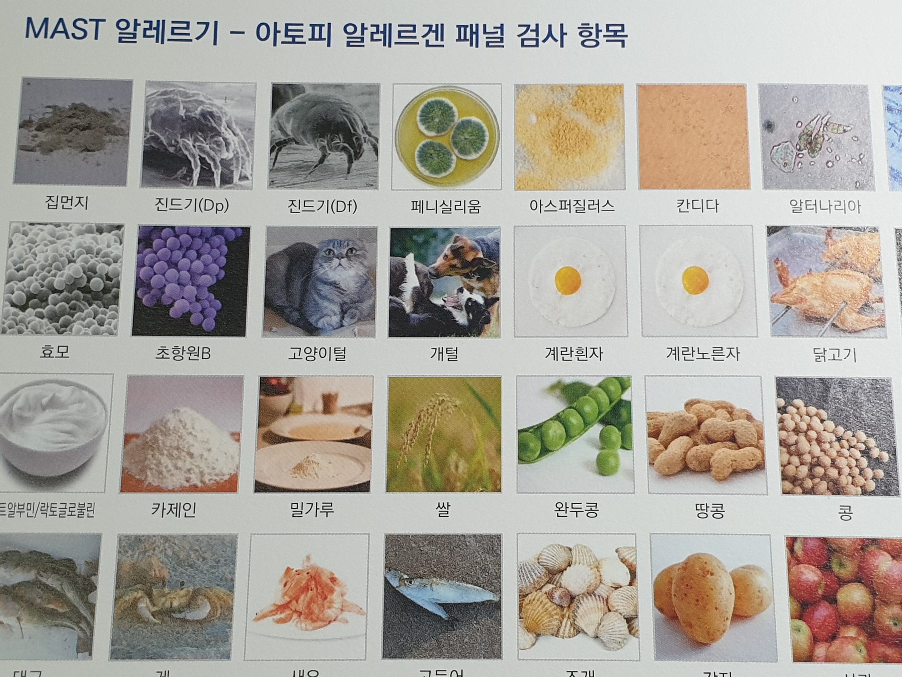 알레르기 검사 항목 2