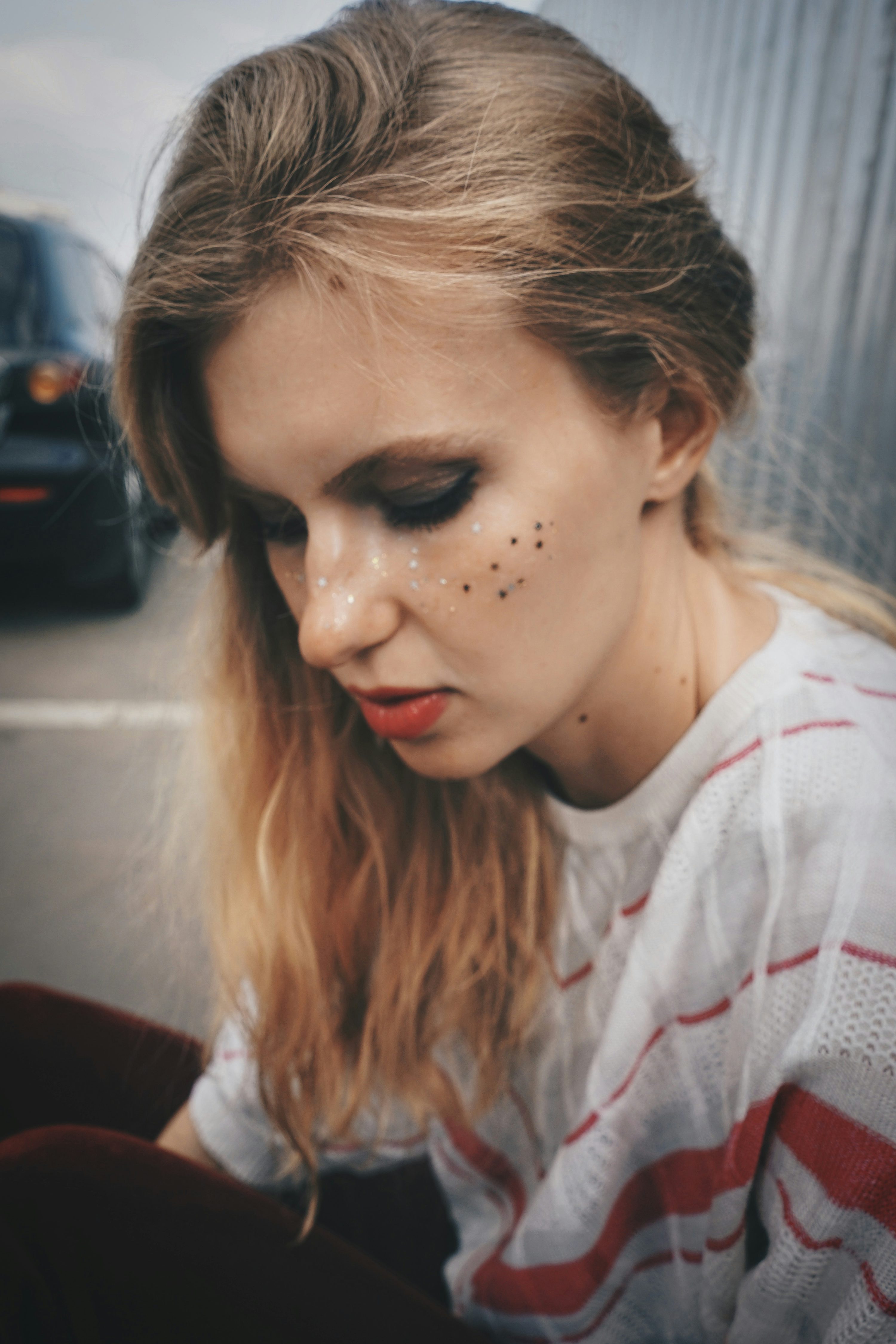 기미 제거 레이저 비용