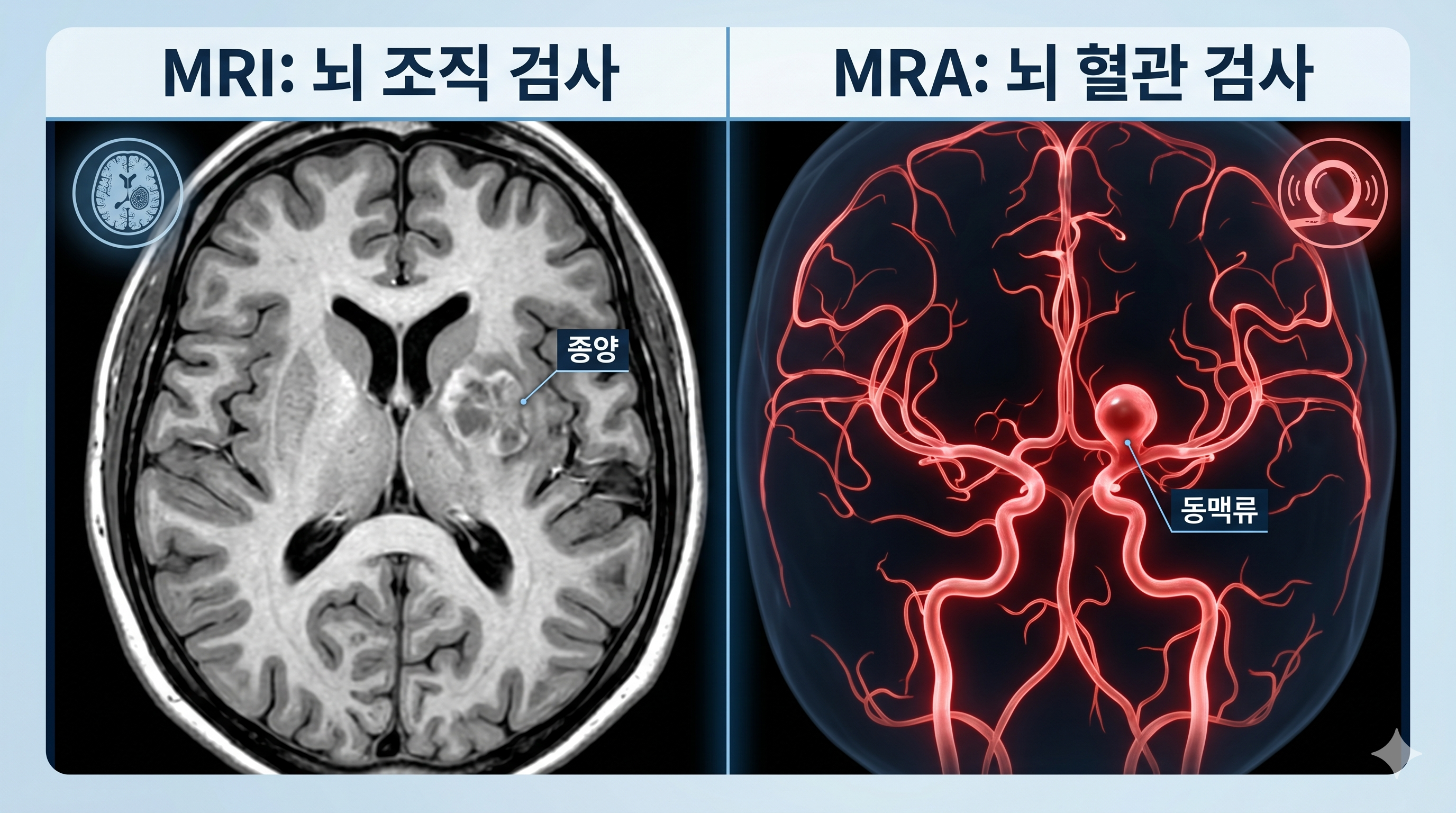 뇌의 단면을 찍어 뇌종양이나 치매, 뇌경색을 찾아내는 흑백의 MRI 사진(좌측)과, 뇌 속의 혈관만을 붉게 추출하여 뇌동맥류 파열 위험을 찾아내는 MRA 사진(우측)을 직관적으로 비교한 3D 인포그래픽