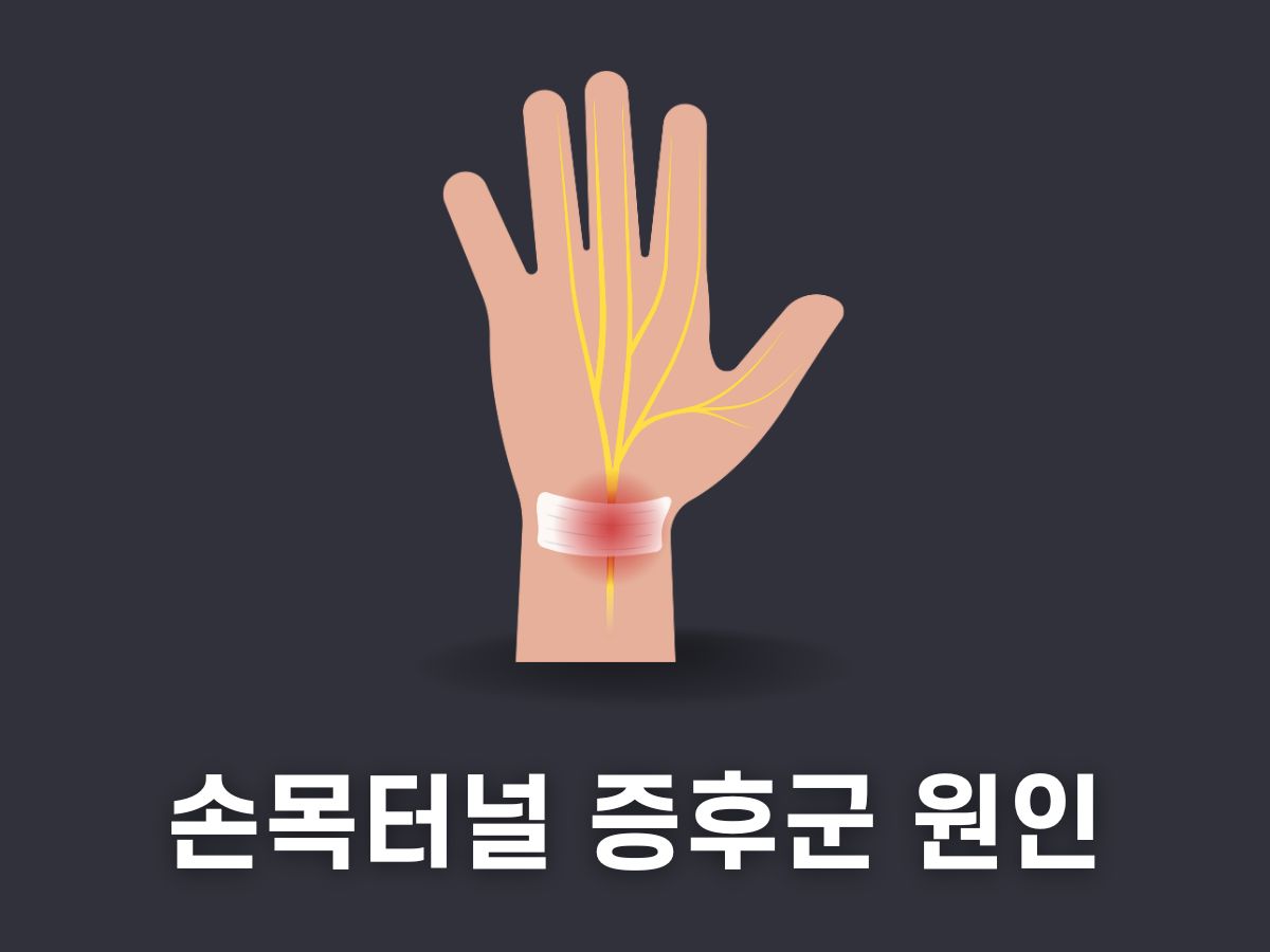 손목터널증후군 원인