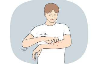 아토피