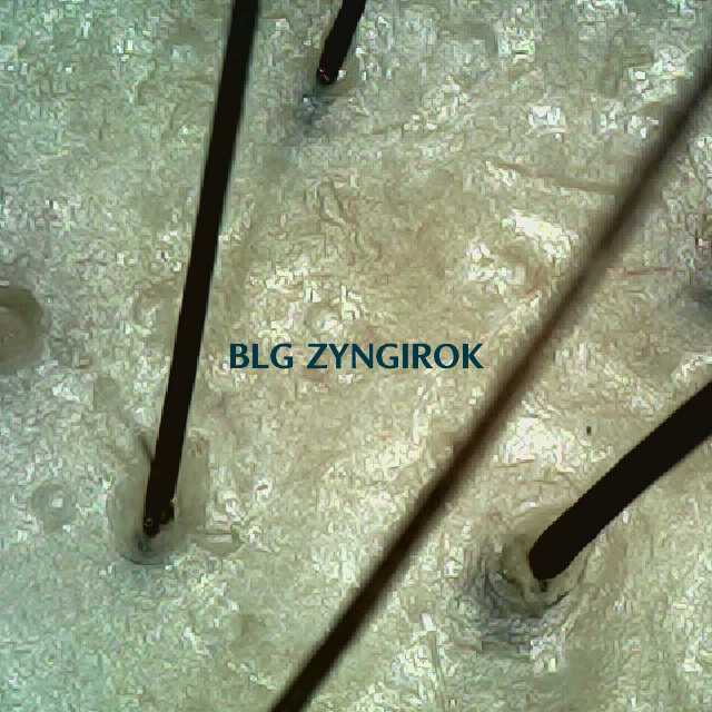 54주차 두피 사진 모습이다.