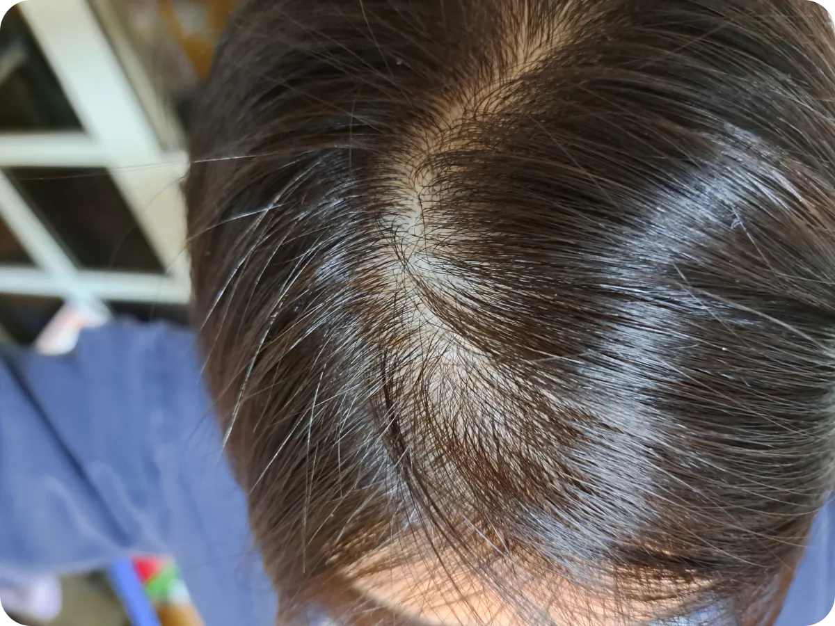 셀프염색-두피보호제-데미프로텍터크림-후기-직후-두피상태