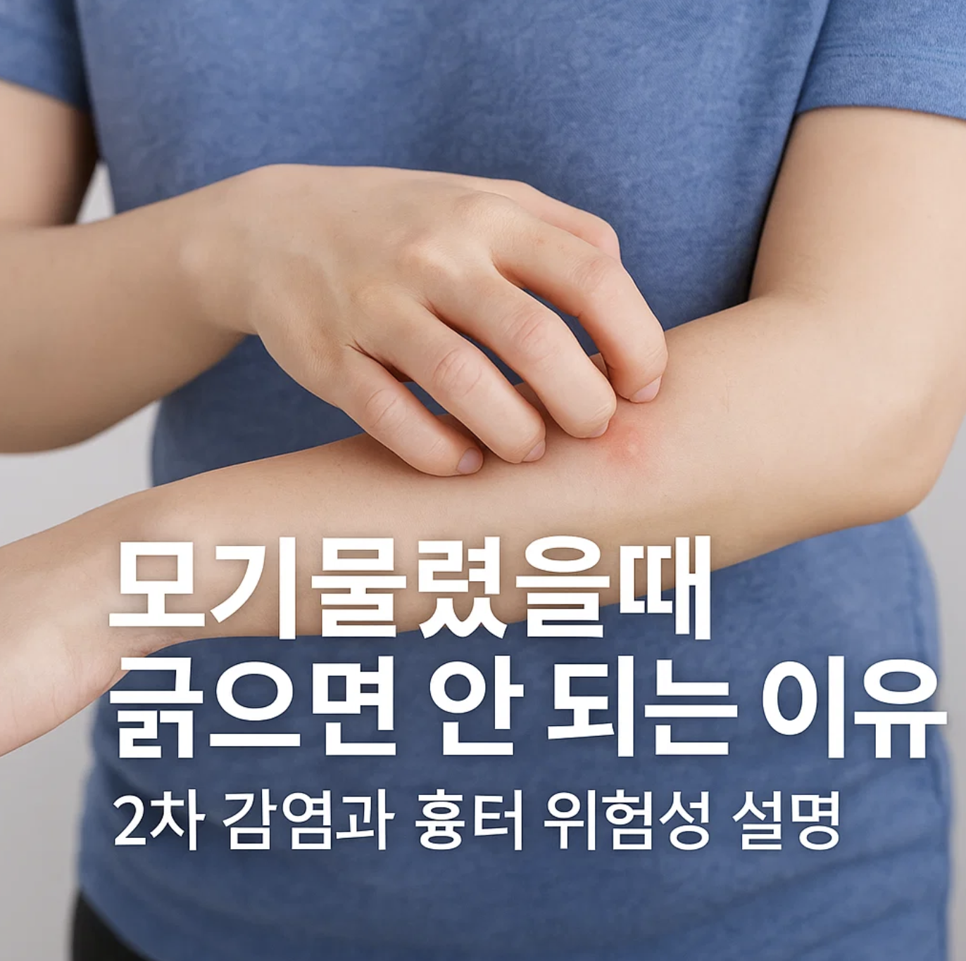 모기물렸을때 긁으면 안 되는 이유, 2차 감염과 흉터 위험성 설명