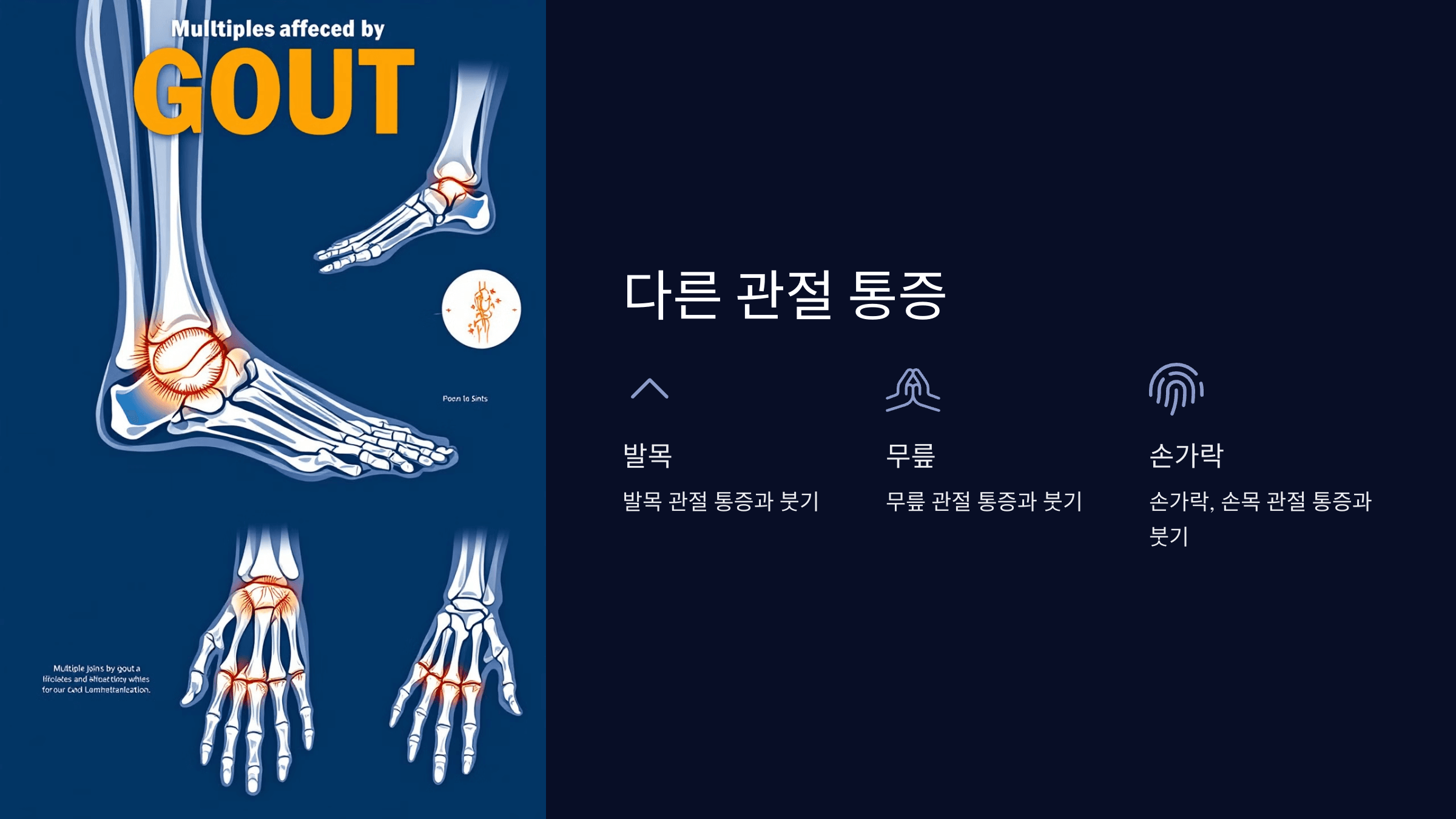 통풍과 관련된 사진입니다.