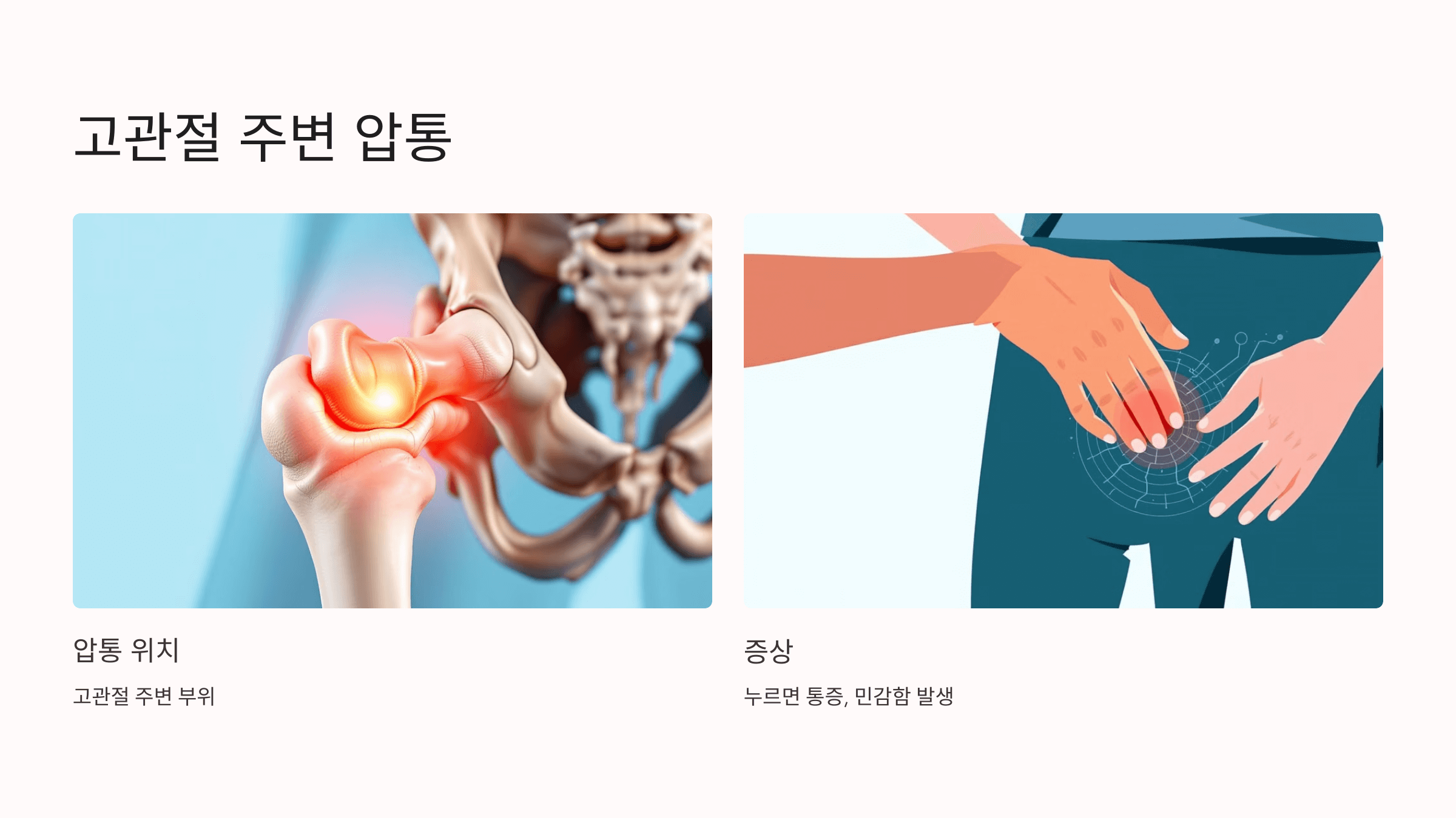 고관절 통증과 관련된 사진입니다.