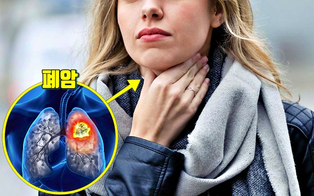 치통 심할때,갑자기 이가 아파요,폐암 전이