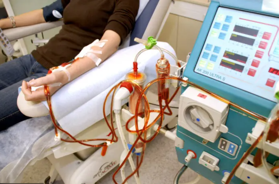 신장 질환 환자를 위한 투석 치료 정리, 절차 및 주의할 점