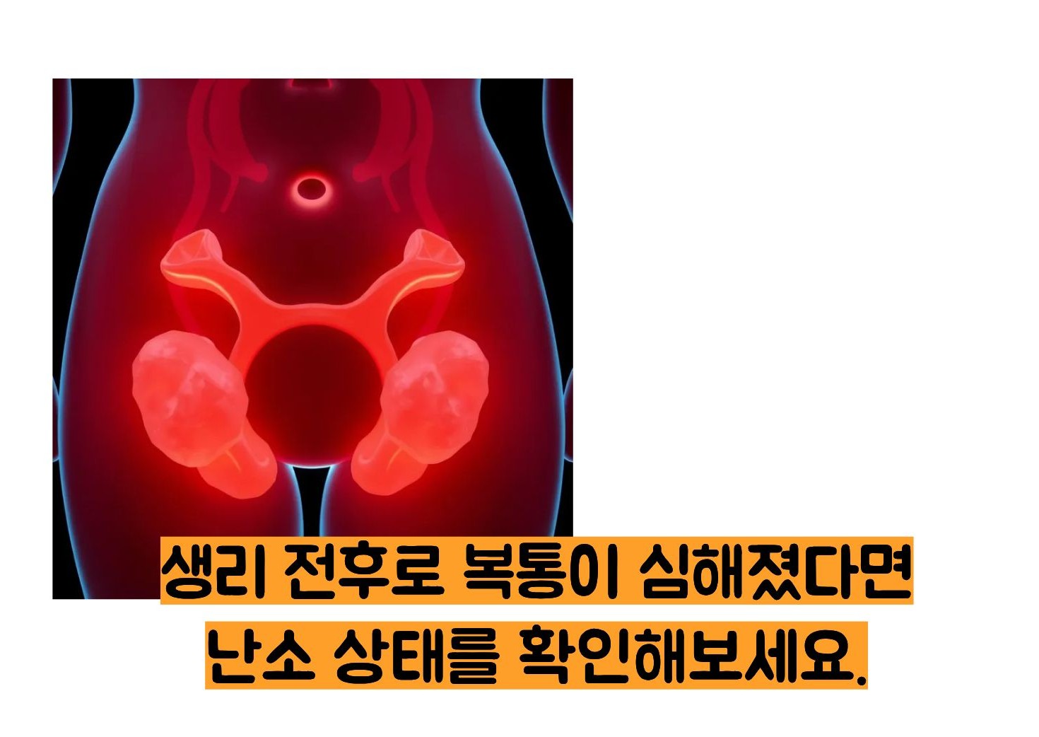 난소 낭종의 증상