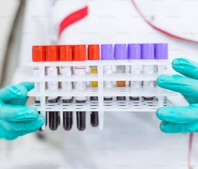 유전자-검사-비용