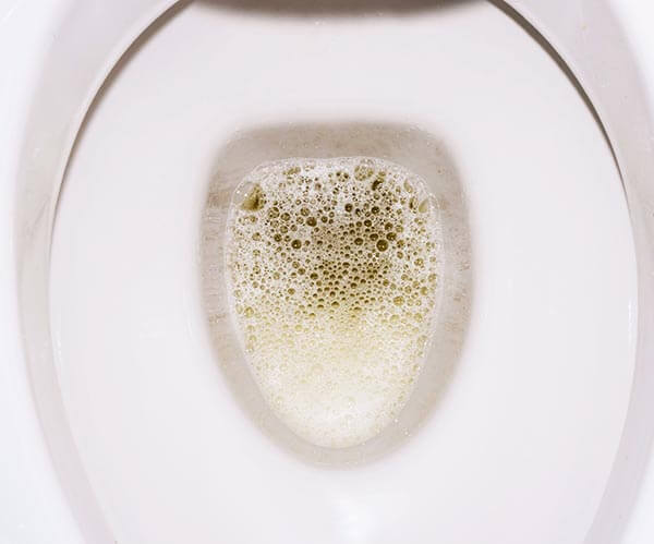 콜라색,거품,탁한소변 의미 알아보자