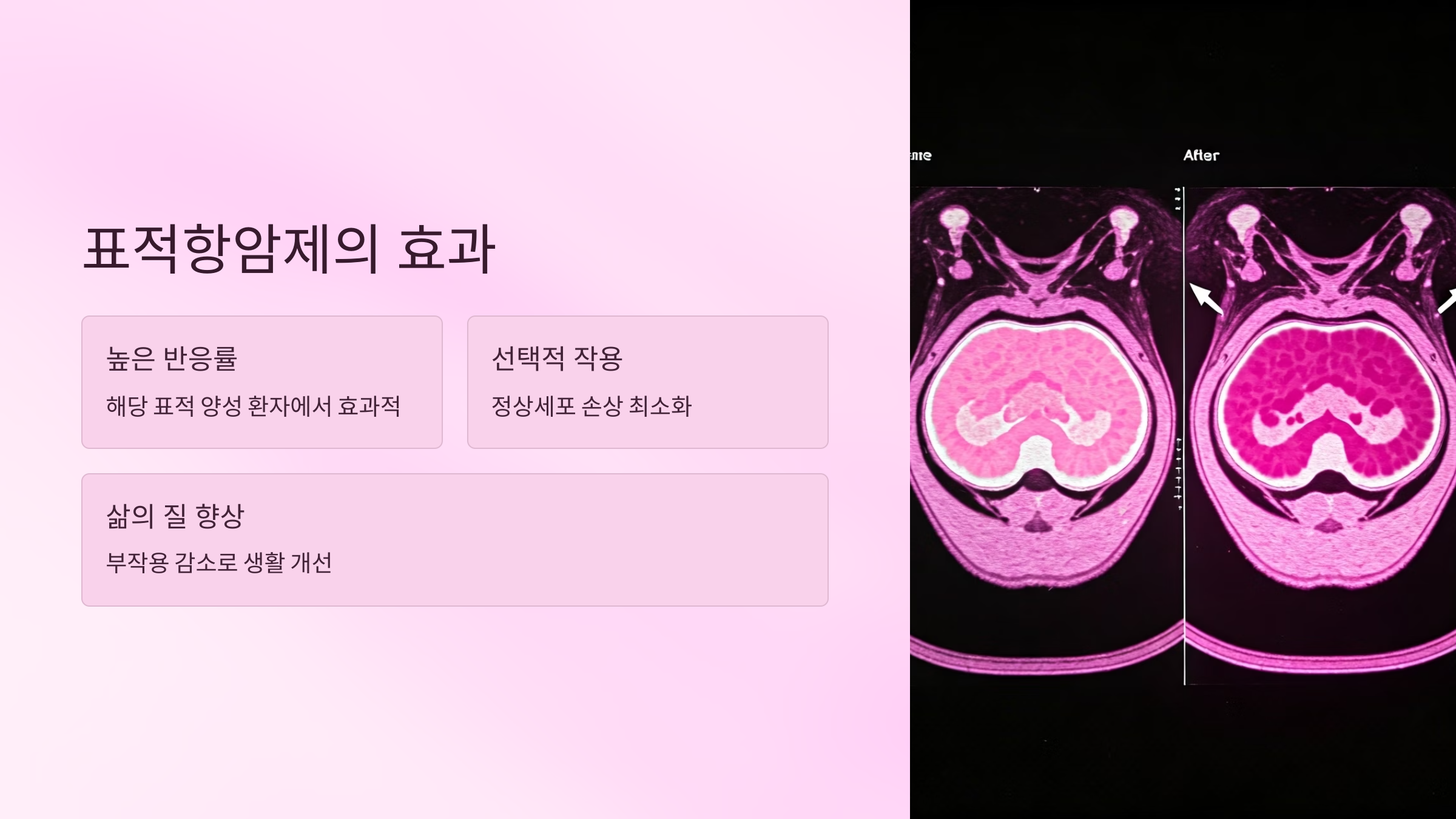 암치료법 선택 표적항암제 효과