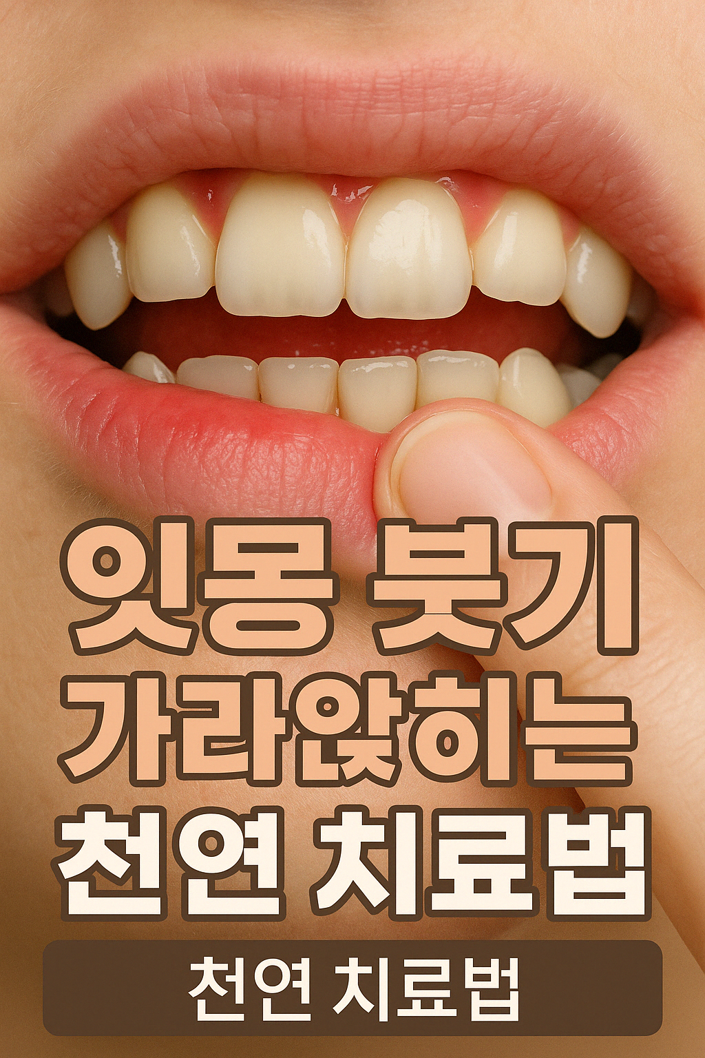 잇몸 붓기 가라앉히는 천연 치료법