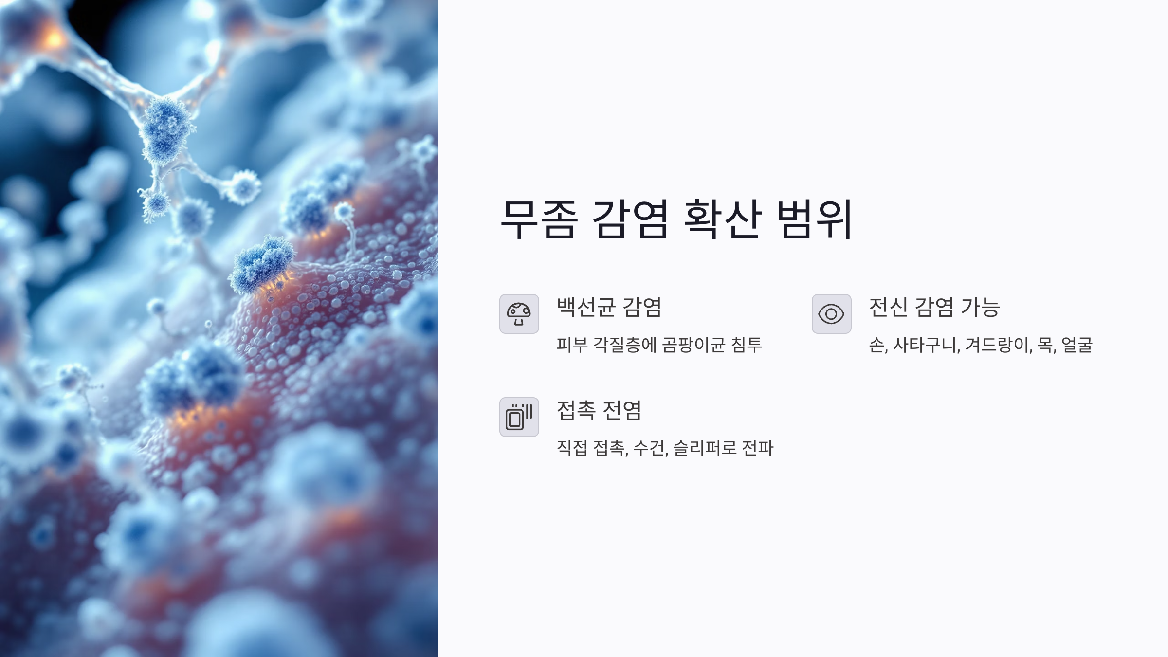 무좀 감염 부위는 어디까지 확산될 수 있을까?
무좀은 백선균이라 불리는 곰팡이균이 피부의 각질층에 감염을 일으키는 질환입니다. 일반적으로 발에 생