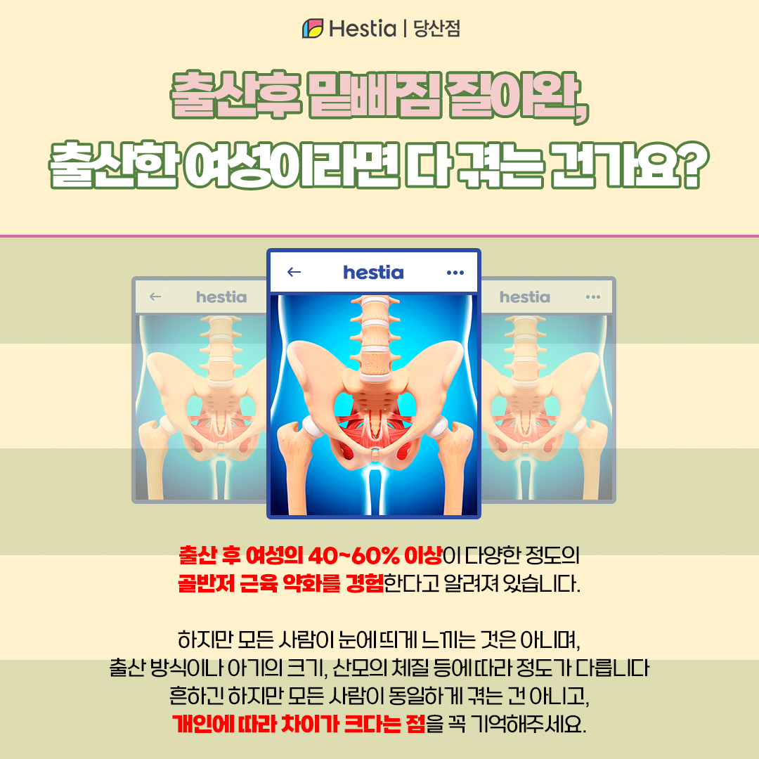밑빠짐통증 느낌, 출산한 여성이라면 다 겪는 문제인가요?