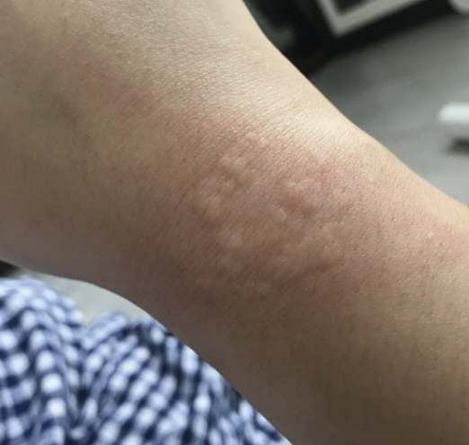 집먼지 진드기 제거방법