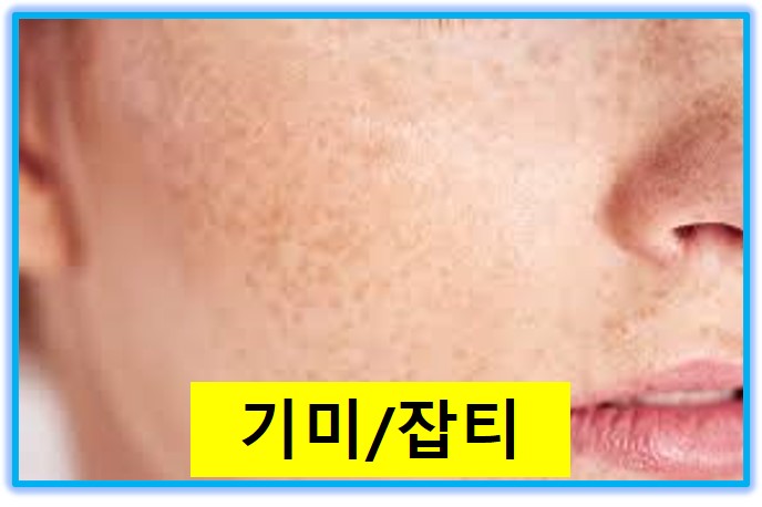 썬크림