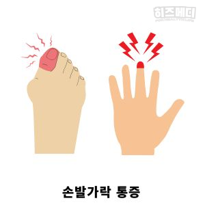 혈소판수치가 높으면