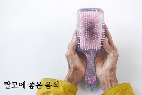탈모에 좋은 음식 알아보기&amp;#44; 탈모 원인