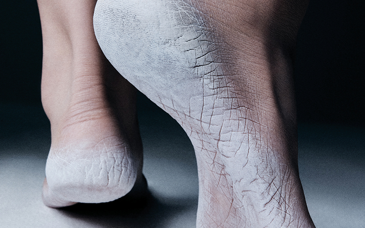 발 뒤꿈치 각질 제거 도구와 족욕