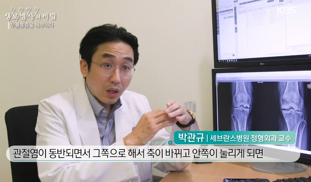 EBS-명의-퇴행성-무릎-관절염-명의-박관규-교수