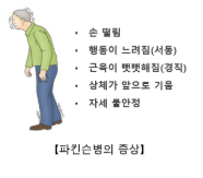 파킨슨병 초기증상 및 원인과 예방법