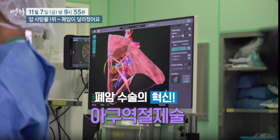 명의 폐암이 달라졌어요