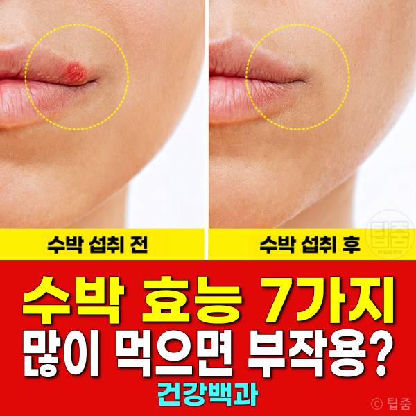 수박 효능 부작용 수박씨 수박껍질 수박은 어디에 좋은 가요